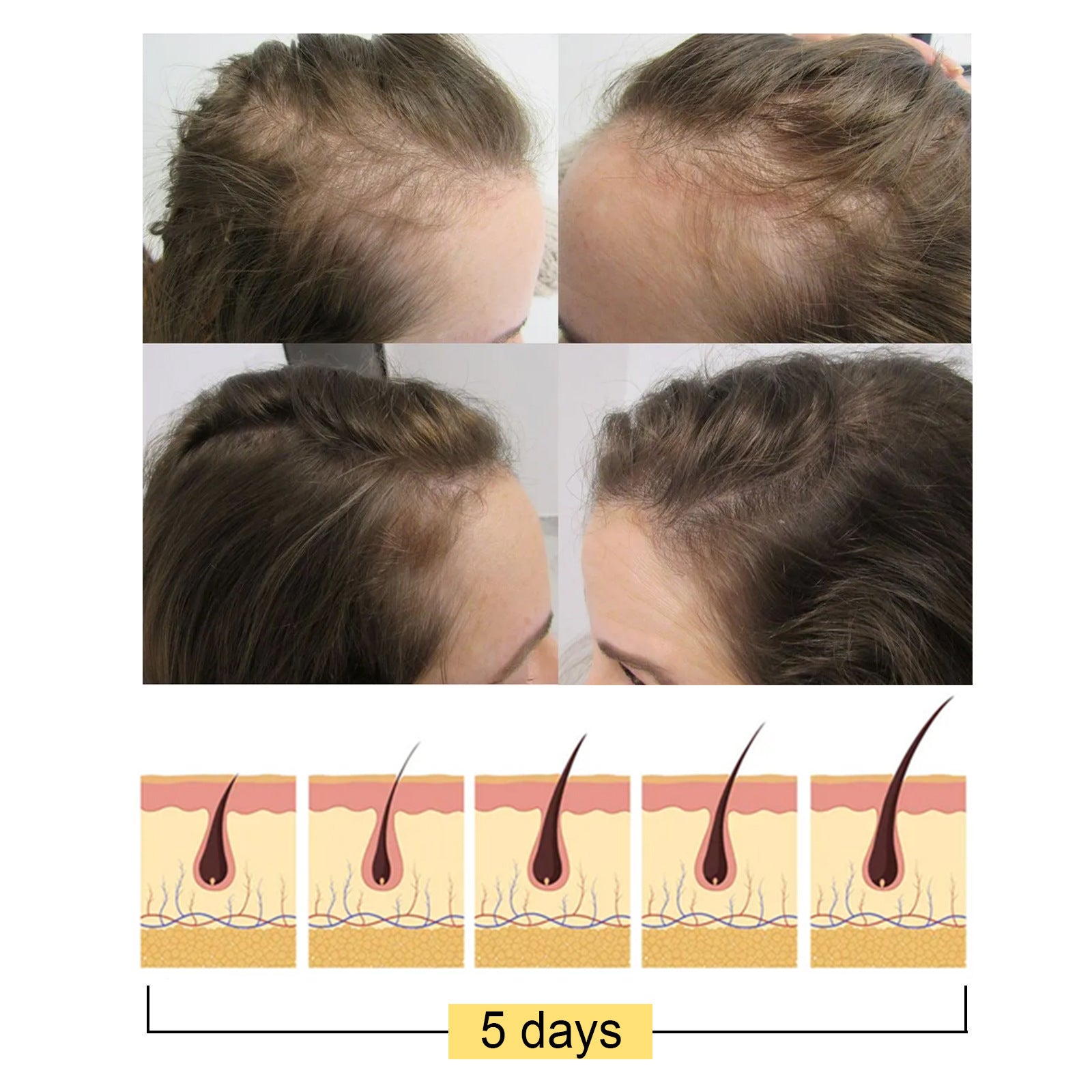 Rice Shampoo Soap Moisturizing Conditioning Hair Growth