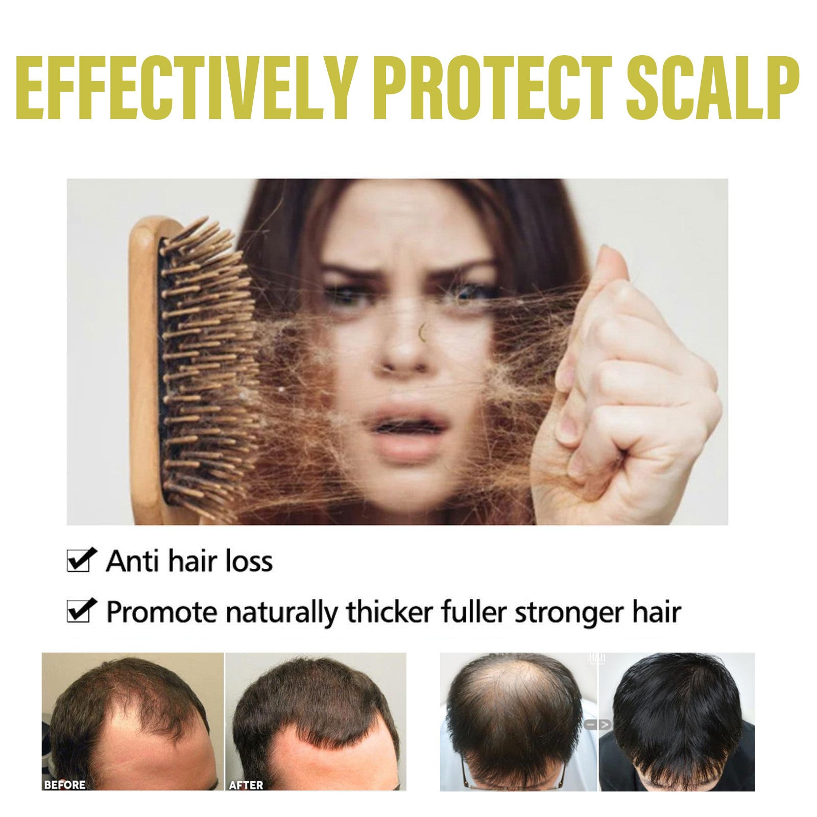 Ginger Dense Hair Shampoo For Relieving Itching