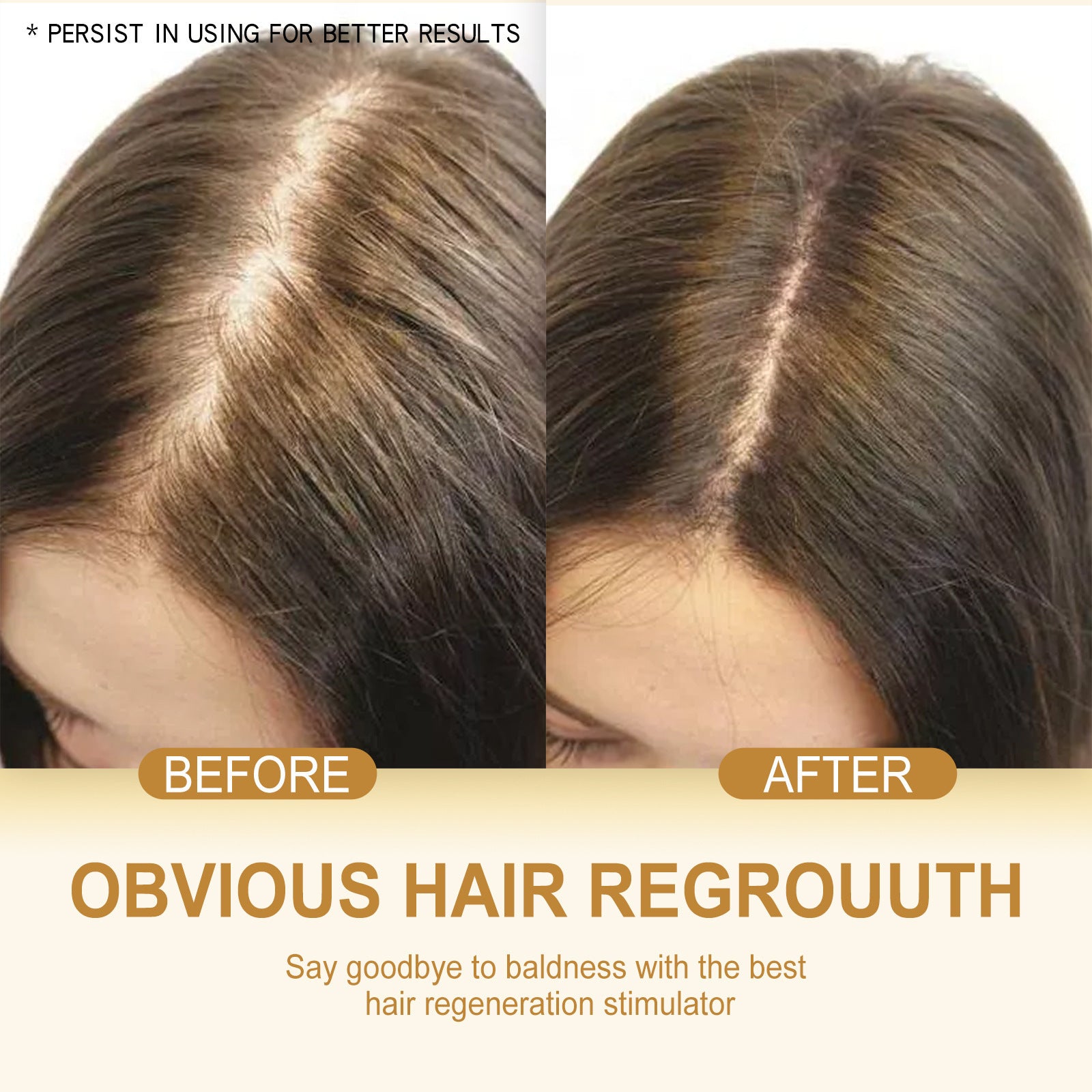 Ginger Conditioning Shampoo Mild Cleaning Anti-drop