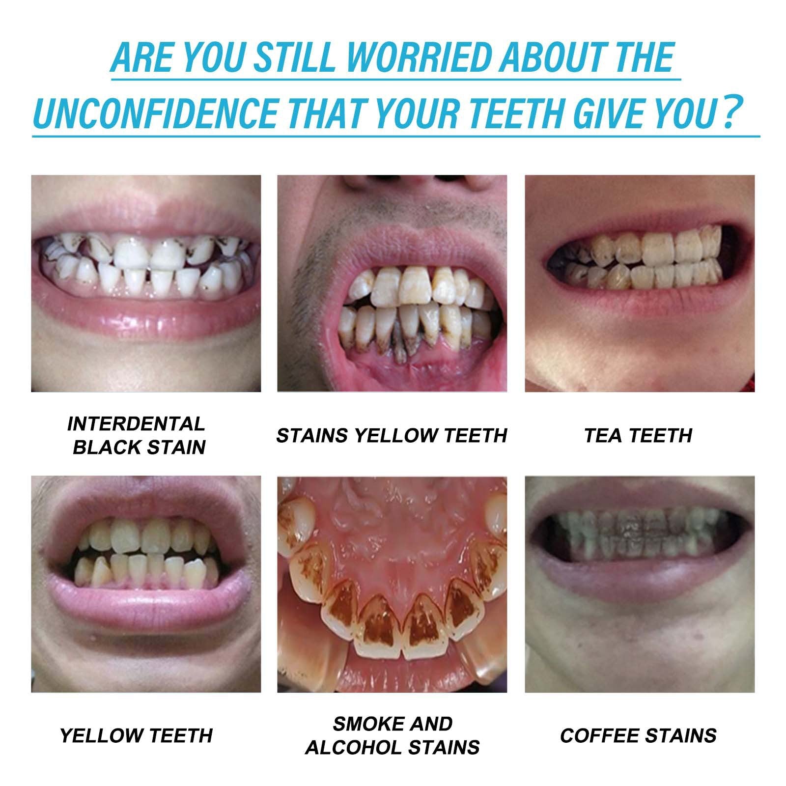 Dental Stain Removing Gel For Gum Repair
