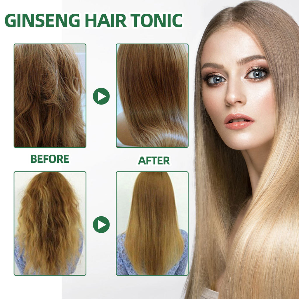 Ginseng Hair Growth Liquid Spray To Prevent Hair Loss